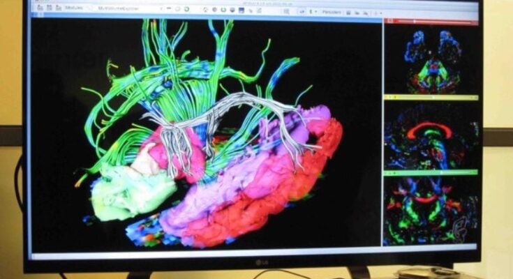 Experts suggest that 13% of treatable conditions are misdiagnosed as dementia