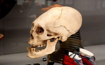 Elongated paracas skull on display in the Horniman Museum, London