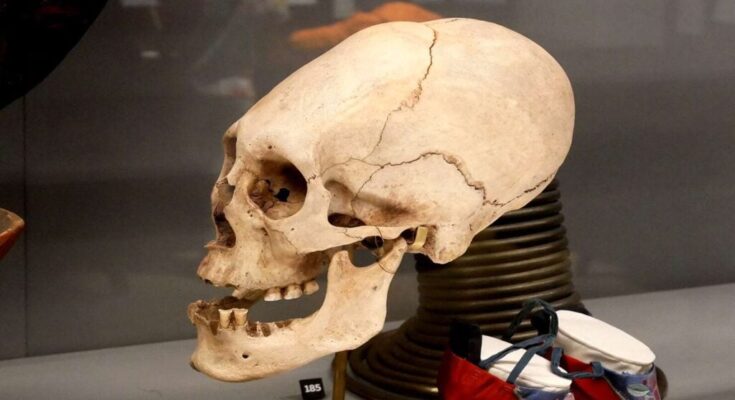 Elongated paracas skull on display in the Horniman Museum, London